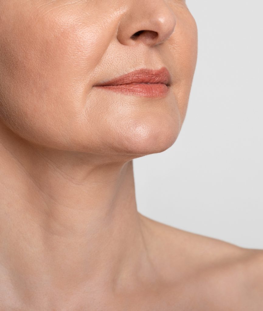 Woman's lips and chin after skin rejuvenation